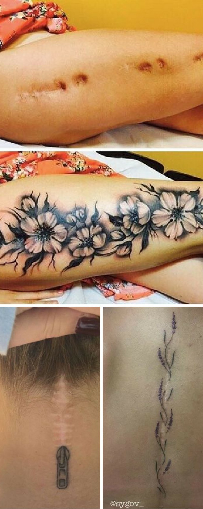 Photos 10 Brilliant Ways To Incorporate Scars With A Tattoo Design